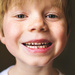 子どもの歯科矯正とは？必要性と小さい頃から気を付けておきたいこと