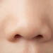 子どもがかかりやすい耳・鼻・口の病気【副鼻腔炎】って？
