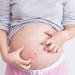 妊娠中期からは要注意！お腹の痒みと乾燥が出てきたらどう対処したら良い？