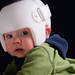 【体験談】頭の形が心配…我が子にフランスでヘルメット治療を開始するまでの話