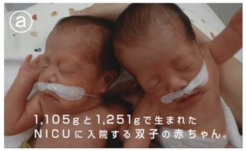 低出生体重の双子の赤ちゃんとその家族の成長の軌跡 元気ママ応援プロジェクト